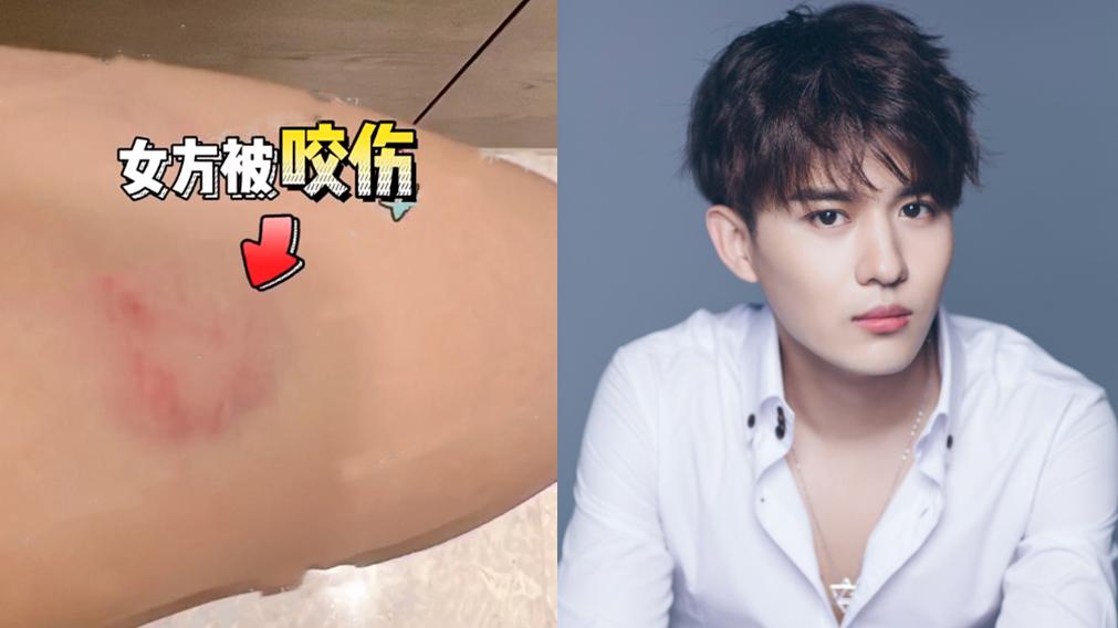 蒙恩|大瓜！24岁男星被曝特殊癖好，出轨咬人样样行，女友泪诉：太疼了