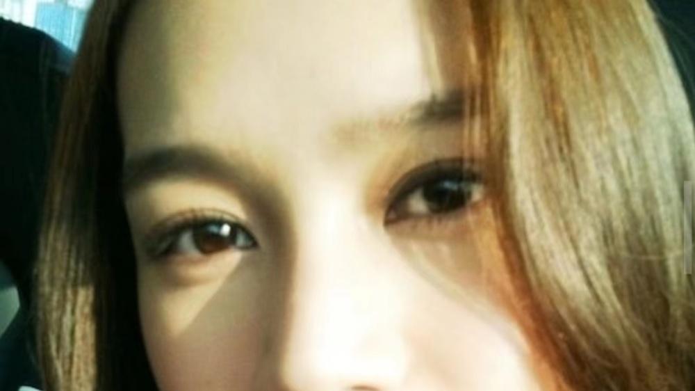 傅嘉莉|好拼！38岁TVB小花为变美去箍牙，曾为拍剧吃荷尔蒙药出现副作用