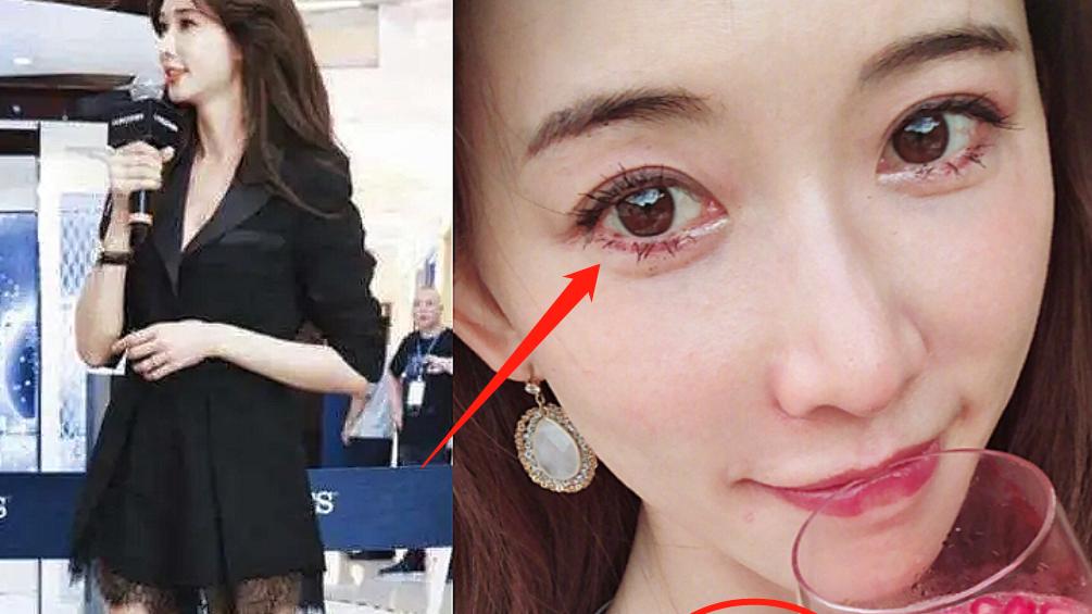 林志玲|曝林志玲家暴后续：脖子淤血、下跪道歉，与张颂文亲密照流出