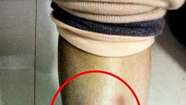 孙菲菲借李玟一事发声，揭秘12年前被打黑幕，打人者是张艺谋徒弟，很是嚣张！