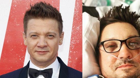 鹰眼|网传鹰眼扮演者伤势严重，险失呼吸能力复原需2年