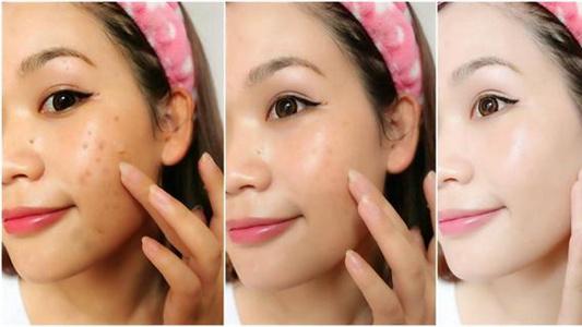 燕麦片|美白淡斑精华哪个好？比去美容院效果还好的美白淡斑精华推荐