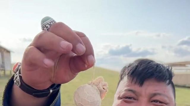 |网红恩克近况曝光：满脸是“疣”，膀大腰圆脖子粗