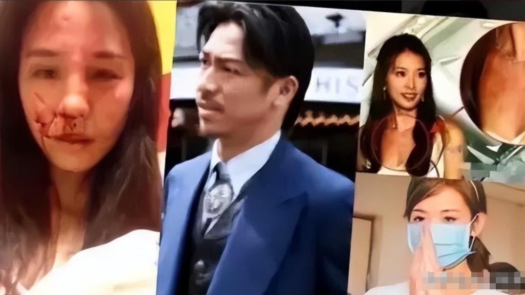 曝林志玲患抑郁自杀，日籍丈夫被曝偷吃3女逼她下跪，网友：活该