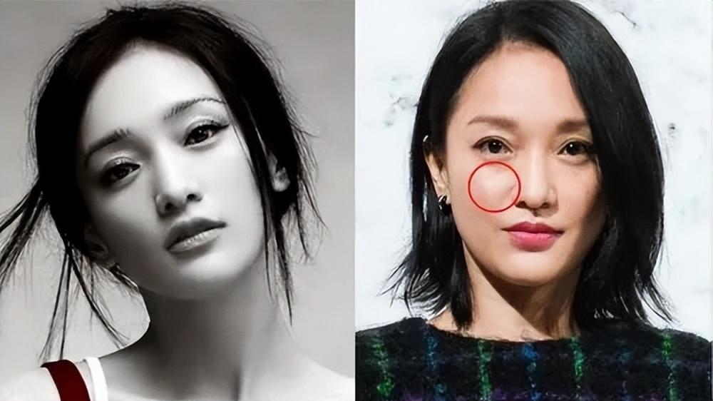 周迅也跑去整容了！采访近照像古天乐吓死人，面部僵硬没法看！