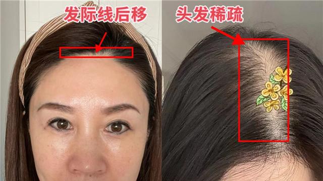 “发际线”有多暴露老态？看素人对比图就知道，年纪越大越要刘海