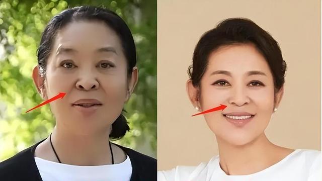 宁愿丑成“怪物”也要永葆青春，这7位明星早已整的“惨不忍睹”