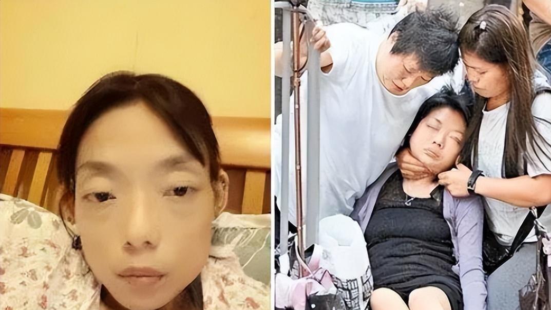 豪门玩物，8年被折磨到牙齿全掉，不足80斤，形似骷髅惨不忍睹！