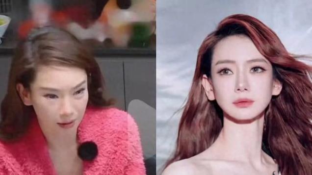 戚薇近照曝光，脸蛋儿肿肿眼神犀利，这是经历了啥？