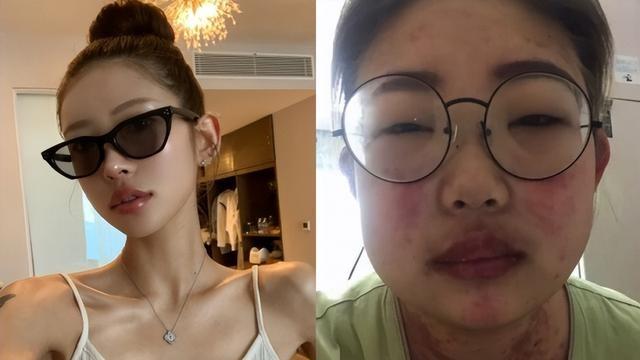 星二代女孩自述逆袭之路，网友：腿像一折就断