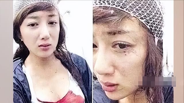 她曾是“古装第一美人”，被狗咬伤后，如今靠演恶毒女配成功翻身