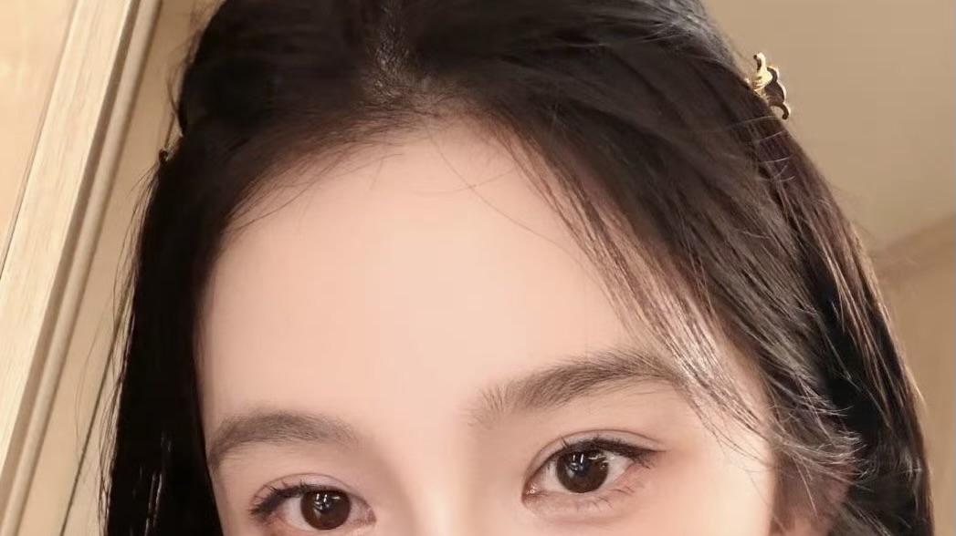 赵樱子“高颅顶”风波：是审美追求还是流量新招？