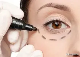 马应龙眼霜效果怎么样？马应龙眼霜去眼袋有效吗？