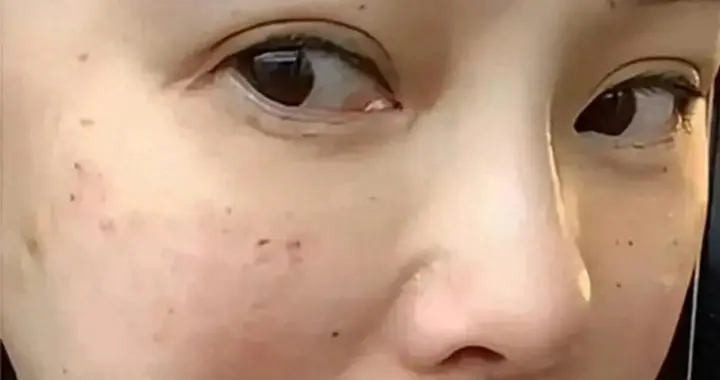 56岁伊能静晒满脸针孔照，直言抗衰痛到流泪：针扎进去时攥着拳头