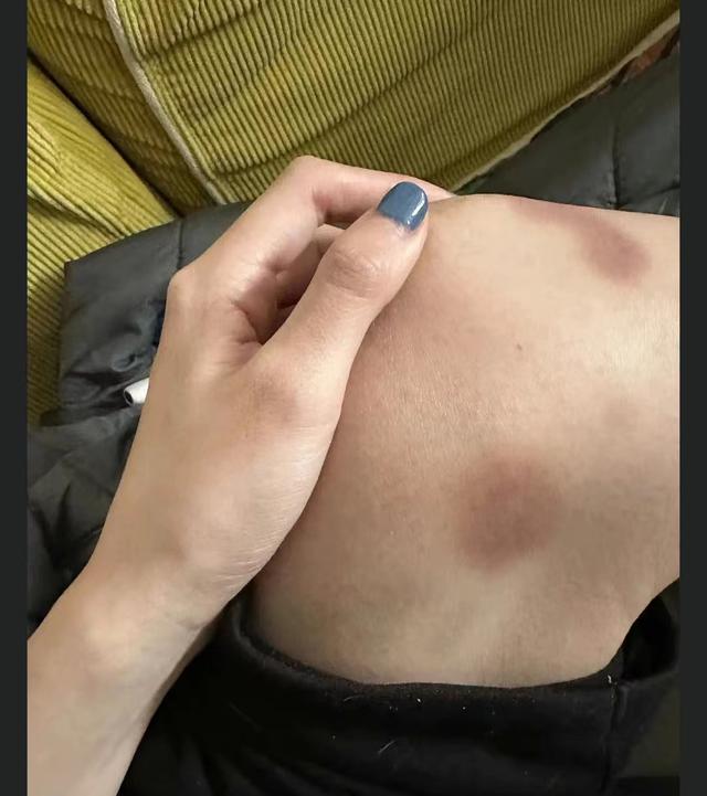 孙天宇|大瓜！疑似前女友发文，曝男艺人出轨无缝衔接，并晒出膝盖淤青照