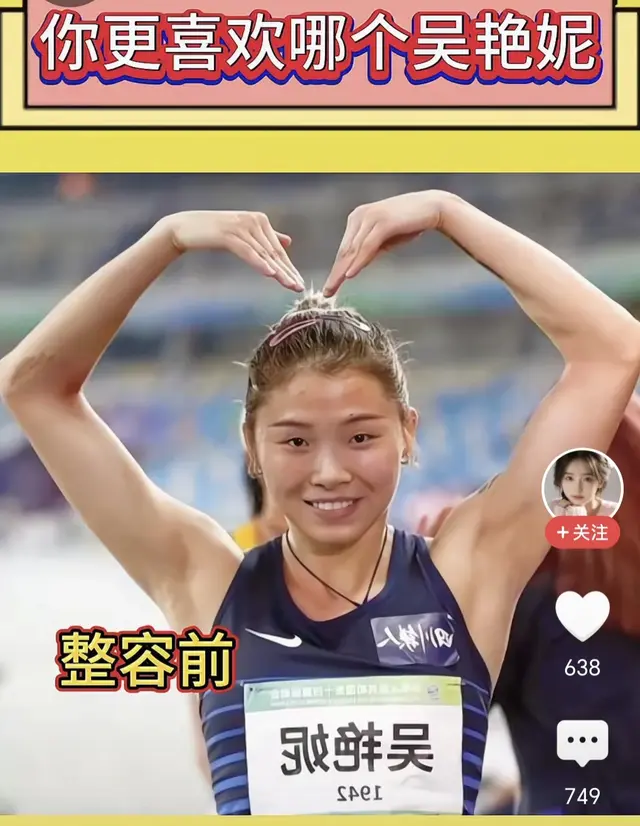 笑晕了！吴艳妮整容前后照片曝光，判若两人！网友纷纷炸裂不敢信