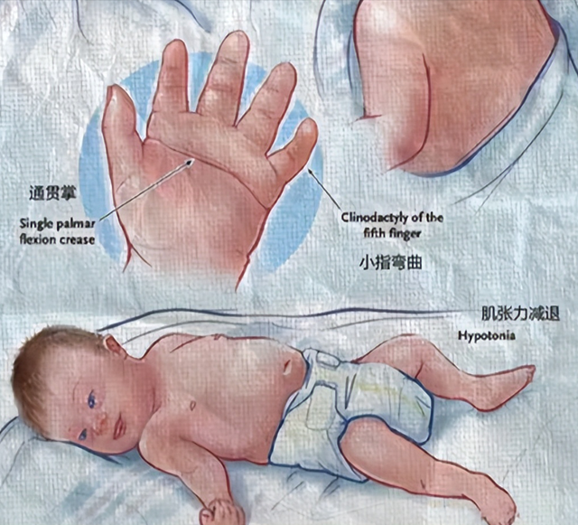 “唐” 字玩梗相关乱象：从对唐氏群体伤害到网络畸形秀！