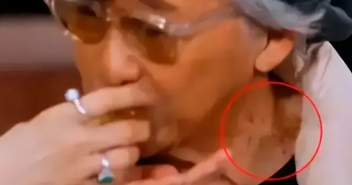 香港著名男星颈部现斑点，进食时眼神涣散，粉丝担心演唱会强度