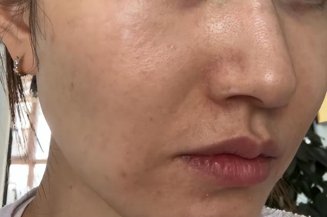 皮肤暗黄粗糙，推荐这几个方法，或能帮你改善