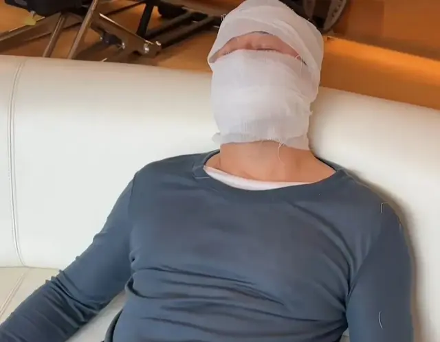 杨坤回应被打传闻，本人自曝脸上缠满绷带真因，网友纷纷点赞