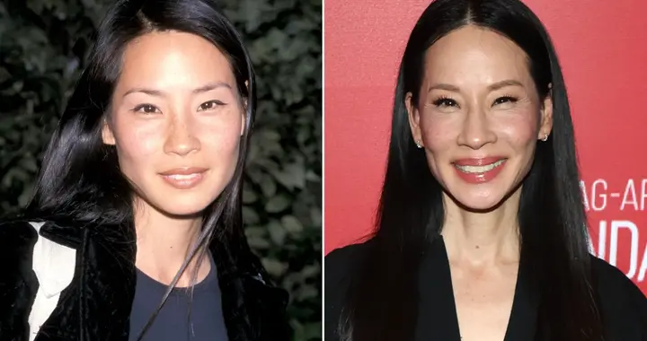 知名女星被误诊癌症挨一刀，结果发现是良性组织