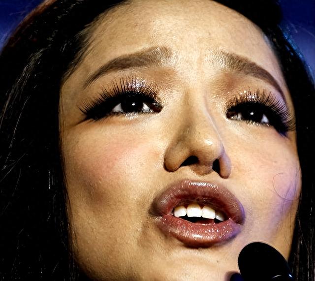 超女冠军江映蓉：整容失败弄得面目全非，被吐槽只剩眼珠是自己的