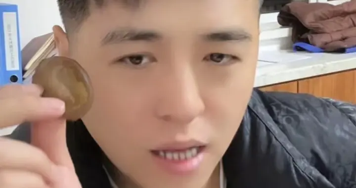 覆巢之下焉有完卵？穷游小峰下场，双方势均力敌，都没好好到哪去