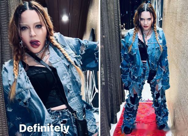 麦当娜|64岁麦当娜承认整容：术后消肿了，看我多可爱