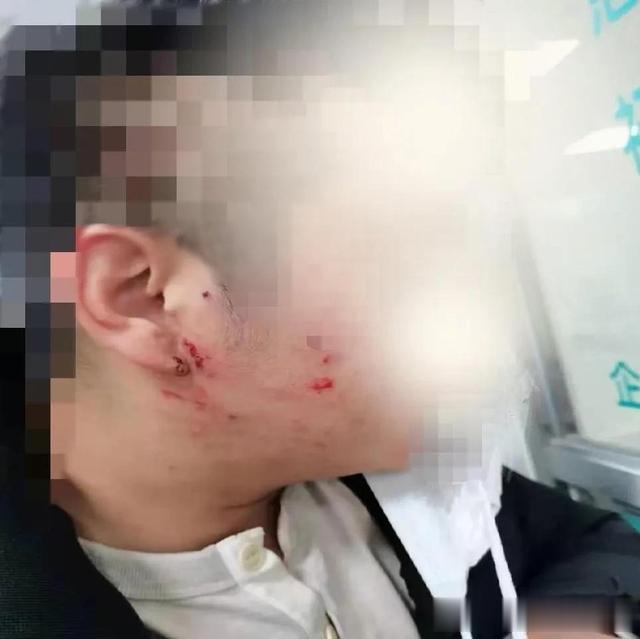 一家人做核酸插队打人 反击者是不是正当防卫