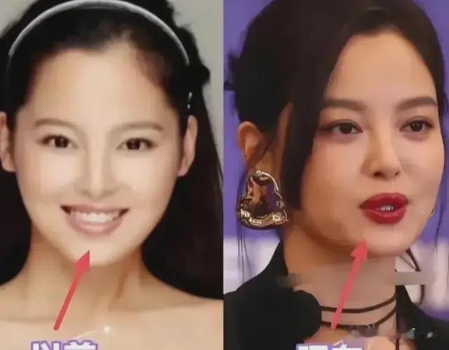 辛芷蕾的嘴唇，10年前长这样，薄唇变\大兔唇\，她到底动了哪里？