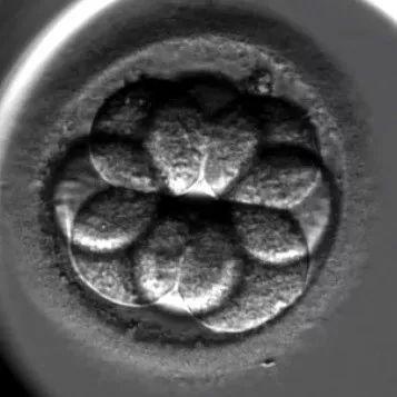 大家来看看，咱们平时移植的八细胞顶级胚胎长什么样～