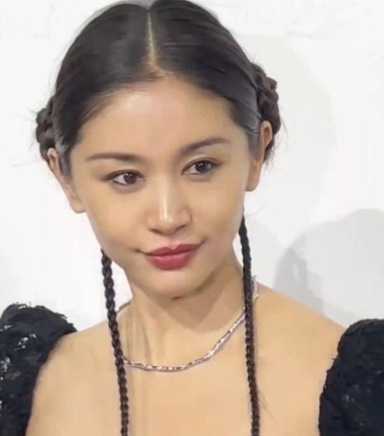 37岁王子文大变样！脸部肿胀扭曲不敢认，网友辣评：医美后遗症