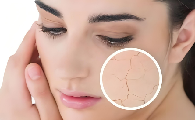 肌肤时常感觉干燥紧绷，解锁水润嫩滑新境界！