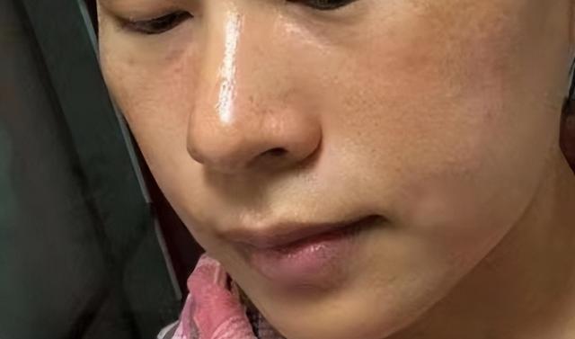 韩素希 色斑为何难以消除？关键在于你有没有做对