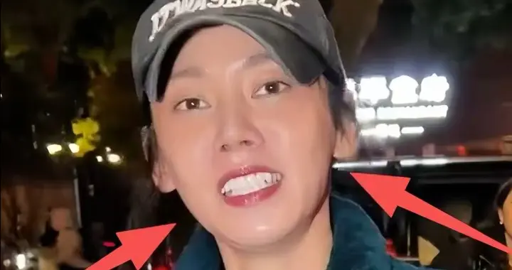 秋瓷炫回国后面相变了，油光满面又僵又肿，当众骂于晓光不留面子