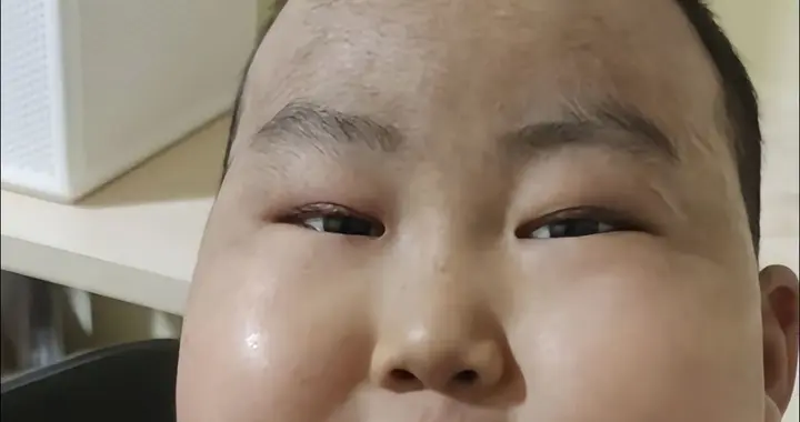 抗癌豪豪去世：6年经历17次化疗、15次放疗，生前终吃上酸菜鱼！