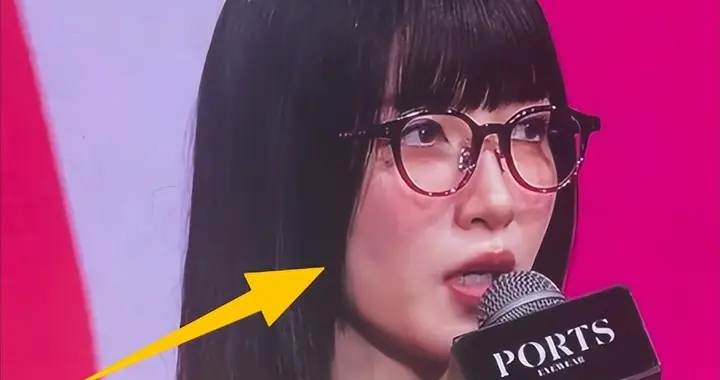 女明星别动脸！39岁江疏影现身活动，嘴歪脸僵、胖到认不出！