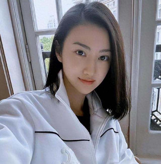 景甜整容翻车了！面部肿胀僵硬，眼睛缩小一倍，女神惨变悲伤蛙