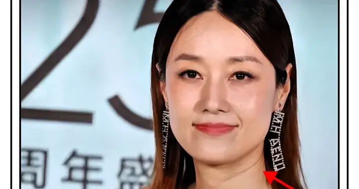 马伊琍ELLE红毯造型翻车，头发黏在脖子上，裙子被网友吐槽像斑马