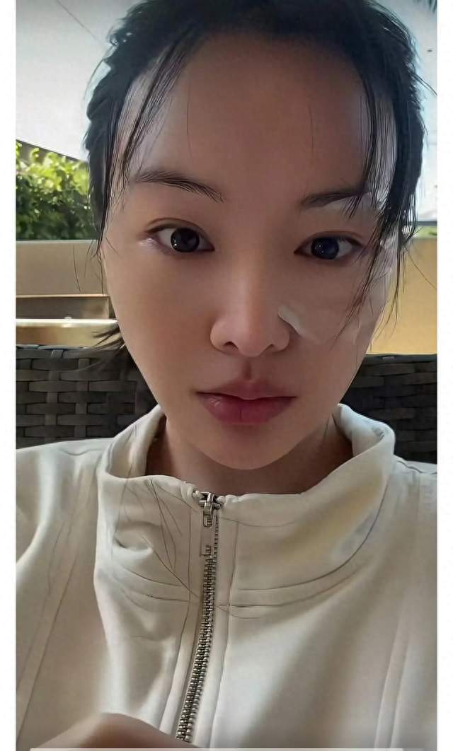 封杀五年后，34岁郑爽在美直播与粉丝重聚，面部僵硬发际线稀疏