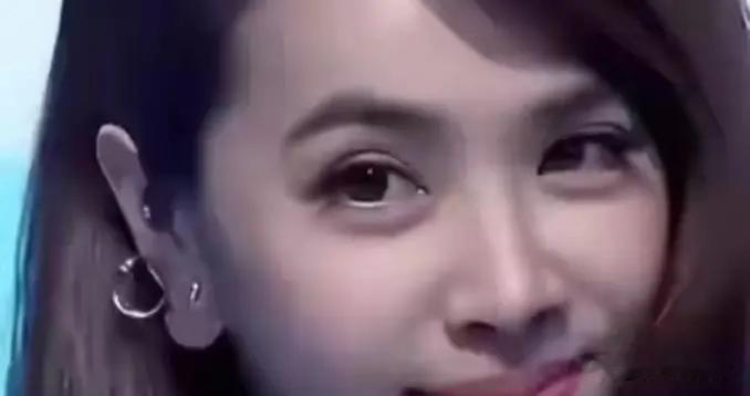 张靓颖自曝患带状疱疹留疤，取消成都跨年加场引关注