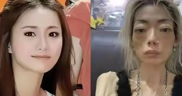 一代女神沦为豪门玩物：结婚8年后牙齿全掉、器官切除、面似骷髅