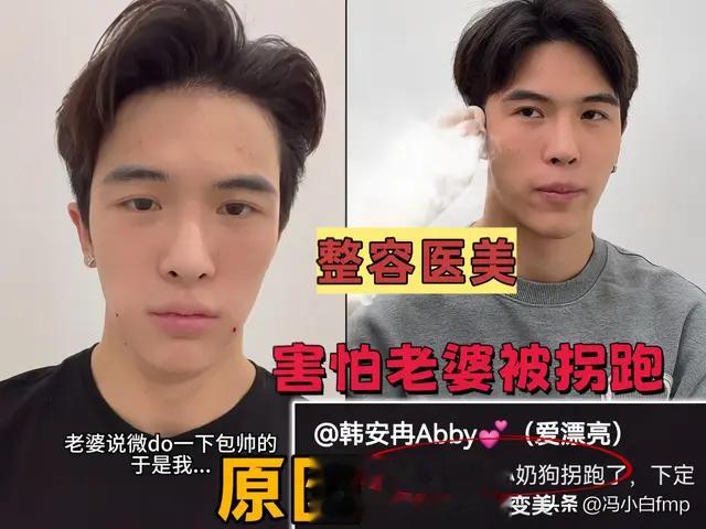 韩安冉老公再次去整容，原因是怕韩安冉被别的小奶狗拐走？