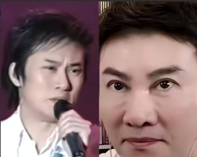 “宁愿丑成怪物”也要永葆青春，这8位明星早已整的“惨不忍睹”