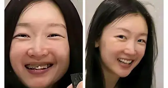 周冬雨素颜上热搜，不是她不化妆，是她压根不瞎折腾。