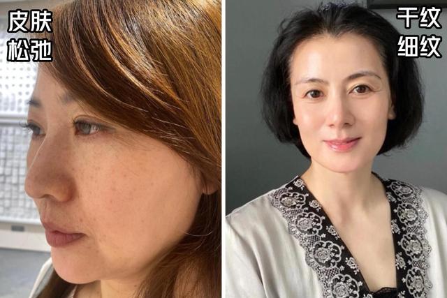 50岁的女人，护肤建议多涂2霜1精华，润白皮肤，用和不用差距大