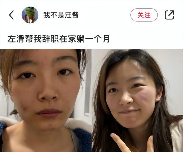 穿衣搭配 “离职，更适合中国宝宝的医美”