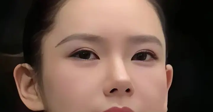 戚薇五官漂亮，她精致的脸盘眼睛是割了双眼皮的，鼻子是垫出来的