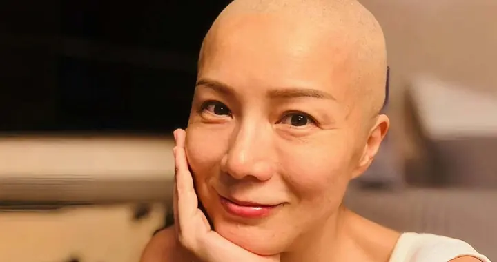 香港知名女星患癌症晚期，做化疗头发掉光，癌细胞在体内四处扩散