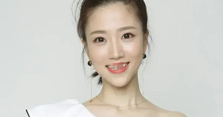 明星高清写真鉴赏｜张纯烨，黑白衬衫裙，绝了